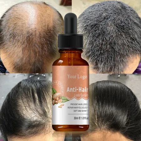 Private Label OEM Fast Natural Organic Herbal Custom Men Care Anti Hair Loss Serum Fall Ginger Hair Growth Oil for Hair Regrowth | Hair Care & Equipment | Personal Care Private Label OEM Fast Natural Organic Herbal Custom Men Care Anti Hair Loss Serum Fall Ginger Hair Growth Oil for Hair Regrowth | Hair Care & Equipment | Personal Care