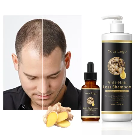 Private Label OEM Fast Natural Organic Herbal Custom Men Care Anti Hair Loss Serum Fall Ginger Hair Growth Oil for Hair Regrowth | Hair Care & Equipment | Personal Care Private Label OEM Fast Natural Organic Herbal Custom Men Care Anti Hair Loss Serum Fall Ginger Hair Growth Oil for Hair Regrowth | Hair Care & Equipment | Personal Care