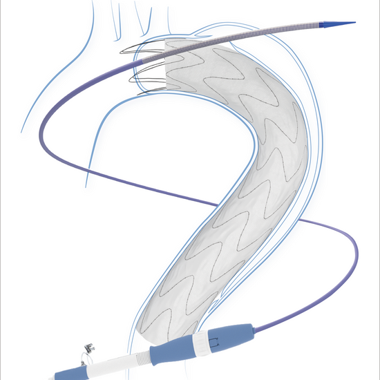 NovoTaper Thoracic Stent Graft System | Surgical Instruments | Health ...