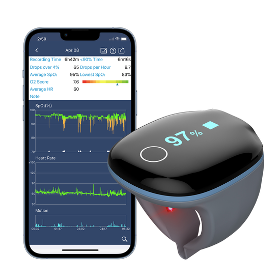 Viatom O2ring Wearable Sleep Oxygen Monitor 